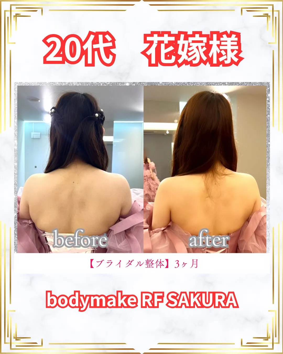 背中美ラインで“後ろ姿の自信”を