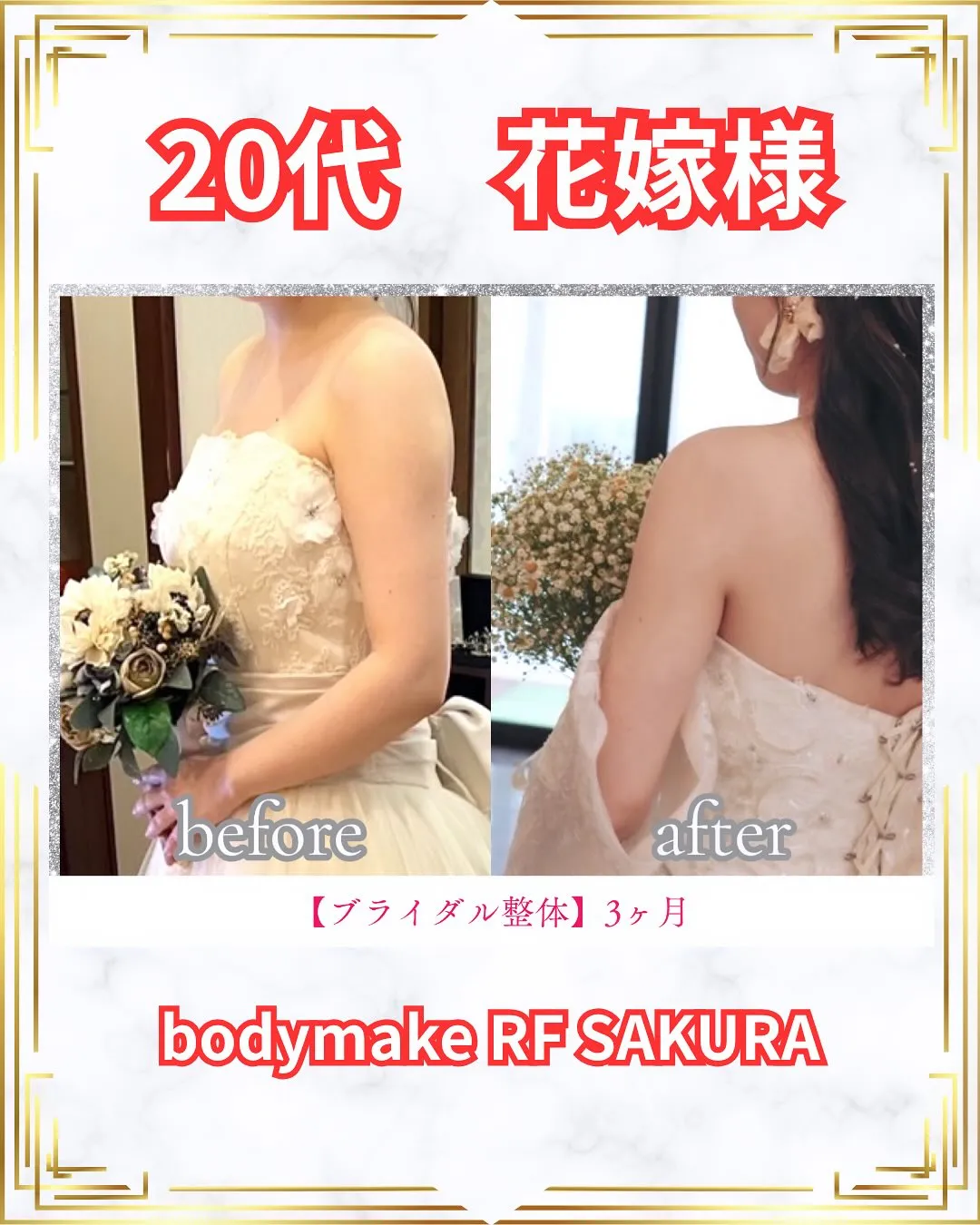 【ブライダル前に“姿勢美人”へ】