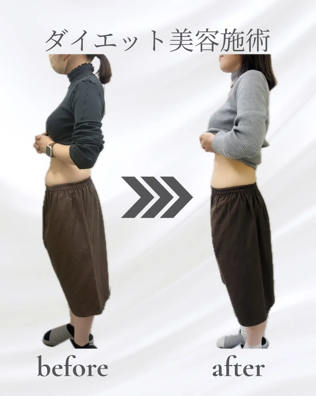 「イベントまでに少しでもキレイになりたい」