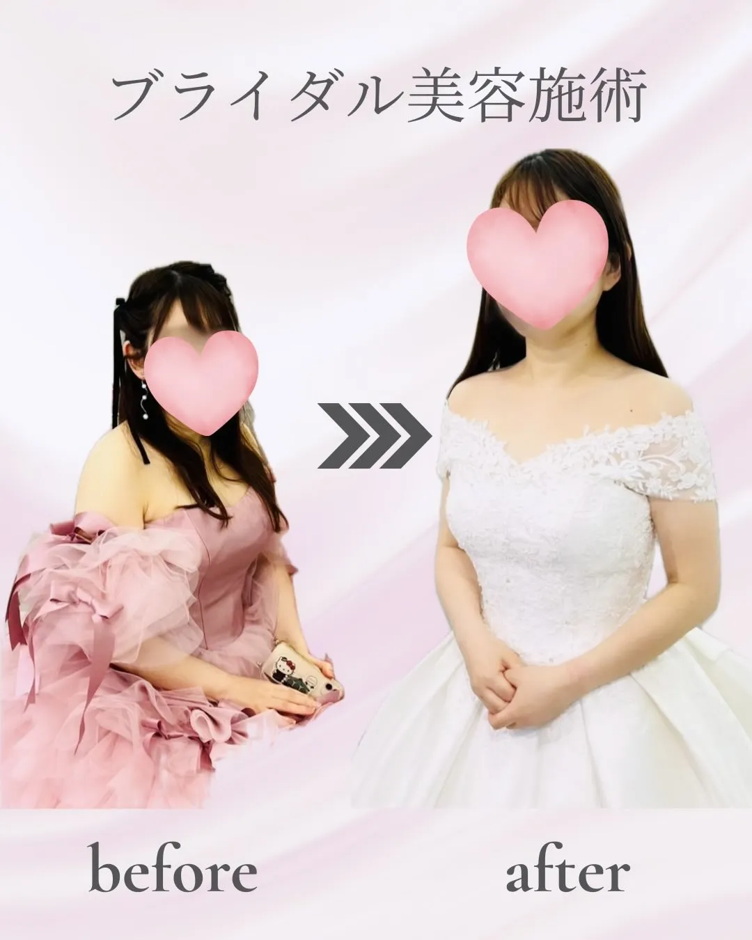 20代の花嫁様をドレス映えできるようにサポートさせていただき...